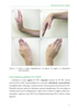 Smart Hand Model. Diagnoza i terapia ręki u dzieci
